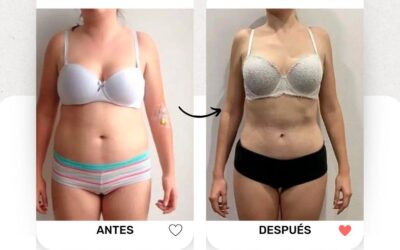Slim Láser es la técnica ideal para obtener tu cuerpo perfecto.