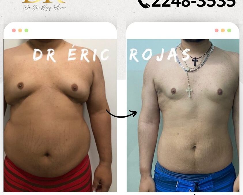 Slim Láser es la técnica ideal para cambiar tu vida.
