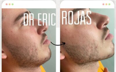 Perfilado facial con la mejor técnica.