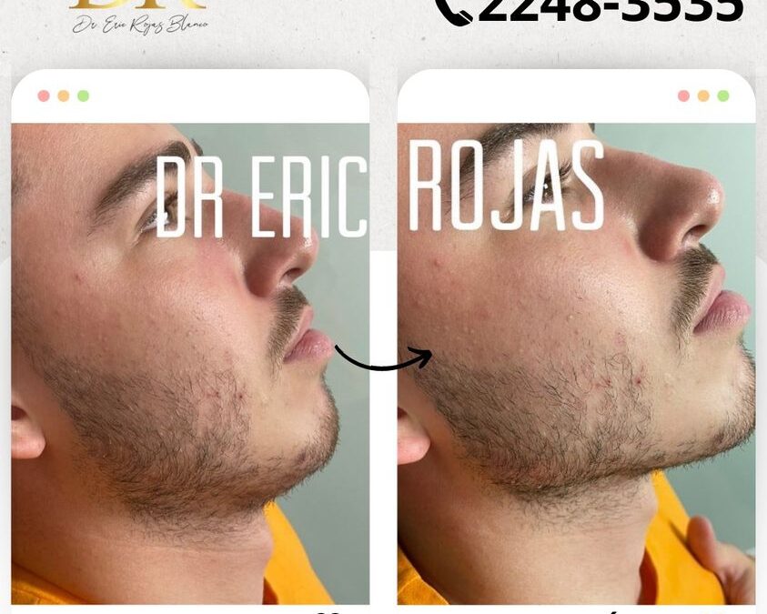Perfilado facial con la mejor técnica.