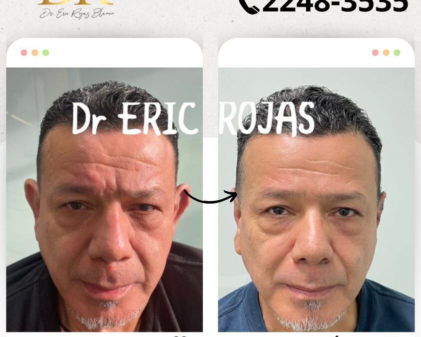 Rejuvenece tu rostro con las mejores técnicas.