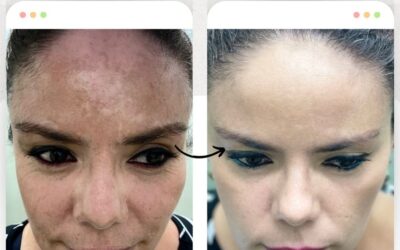 Limpia tu rostro y elimina todas las manchas.