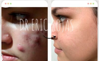 Limpia tu rostro.