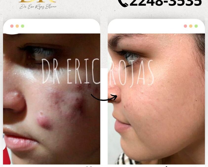 Limpia tu rostro.