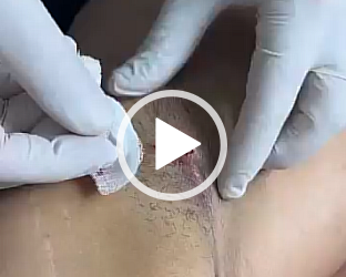 Dr.Eric Rojas