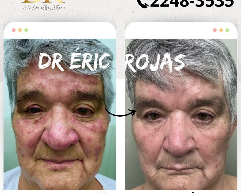 Todos los tratamientos para su piel los tenemos a su disposición.