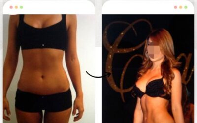 Slim Láser para crear cuerpos increíbles.