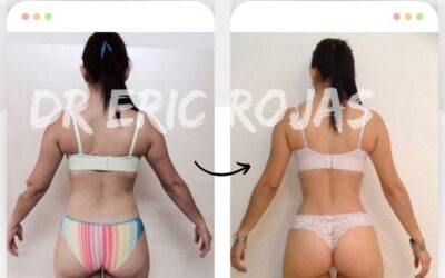 Slim Láser, los cambios más increíbles los logramos.