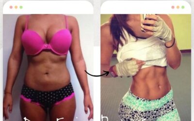 Slim Láser Abdomen.