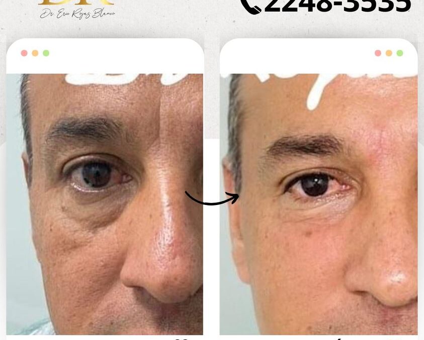 Rejuvenece tu rostro con las mejores técnicas.