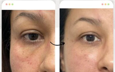Rejuvenece tu rostro.