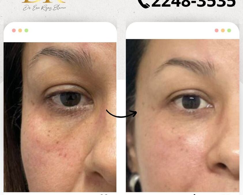 Rejuvenece tu rostro.