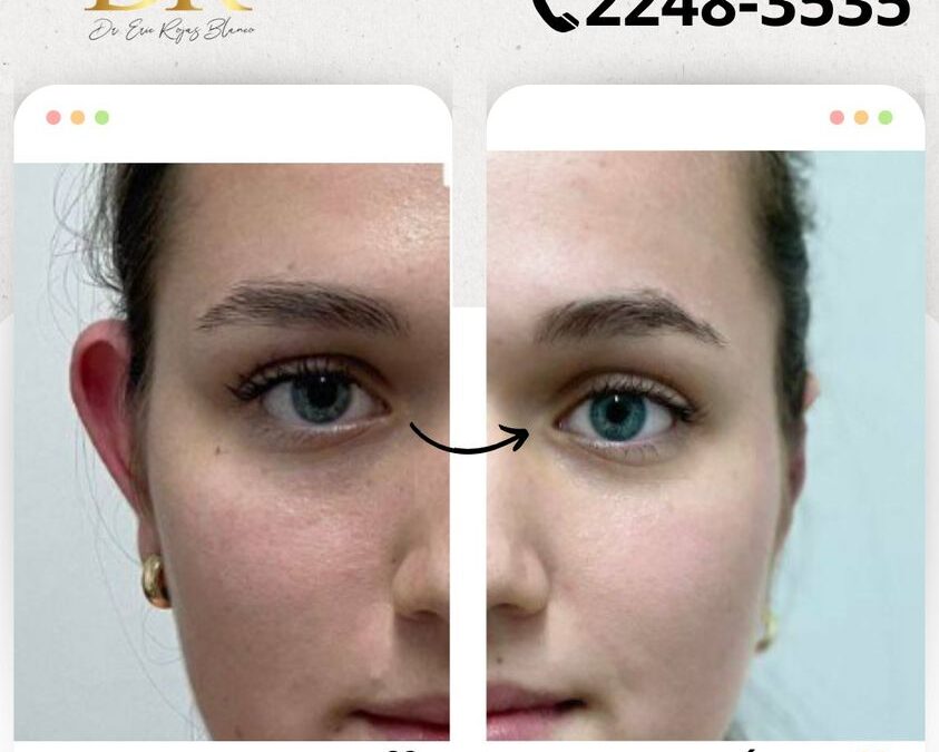 Contamos con la mejor herramienta para eliminar la celulitis.