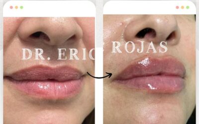 Puedes obtener estos labios al mejor precio.