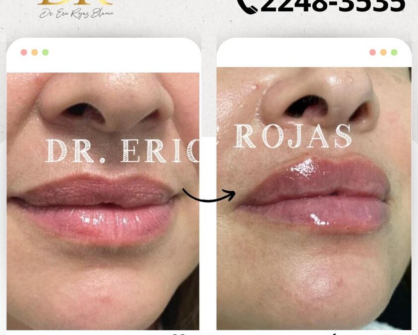 Puedes obtener estos labios al mejor precio.