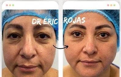 Aprovecha y realizate un refrescamiento facial.