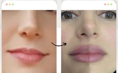 Los Labios que Deseas los hacemos realidad.