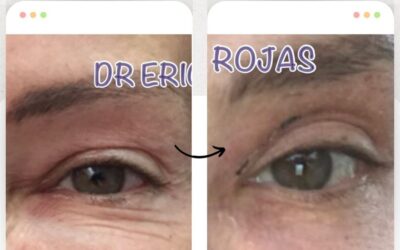 Rejuvenece tu rostro, luce genial.