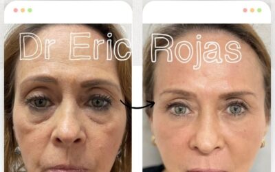 Rejuvenece tu rostro con las mejores técnicas.