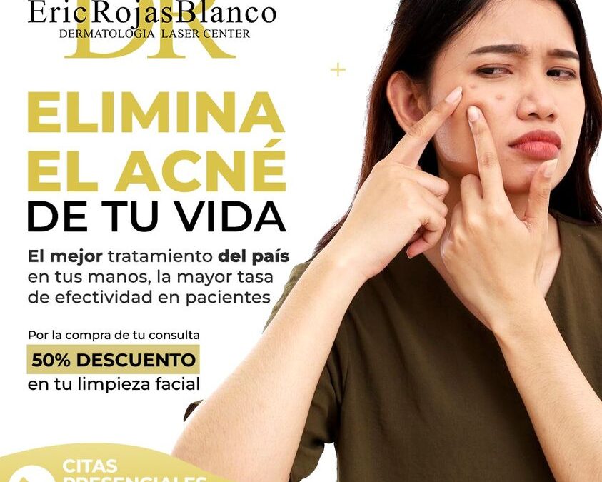 DrEricRojas | Elimina el acné de una vez por todas, te hacemos un 50% de descuento en tu limpieza facial, por la compra de tu consulta.