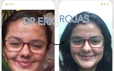 ¿Tienes problemas en tu piel?, Somos expertos.