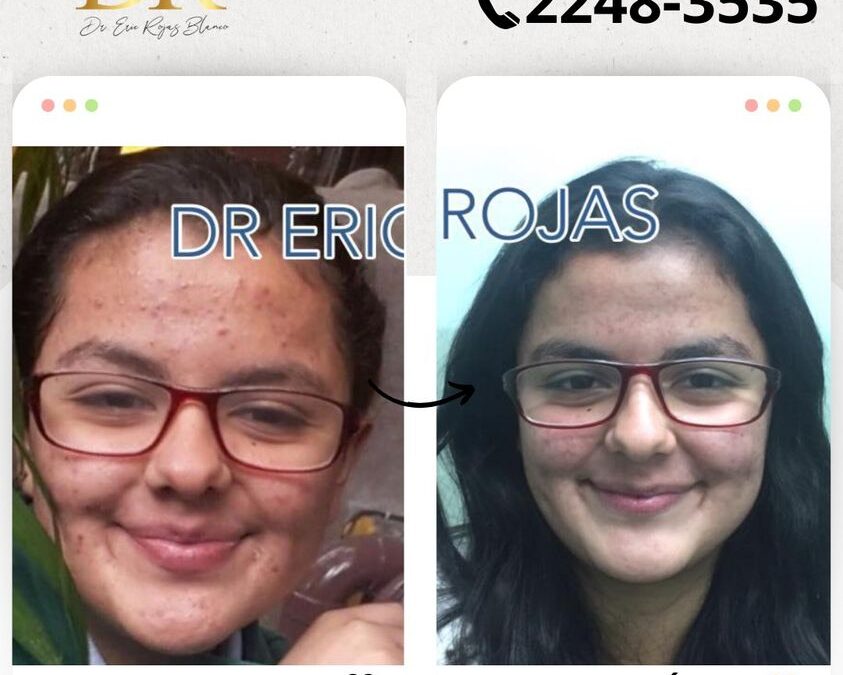 ¿Tienes problemas en tu piel?, Somos expertos.