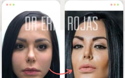 Perfilado facial con la mejor técnica.