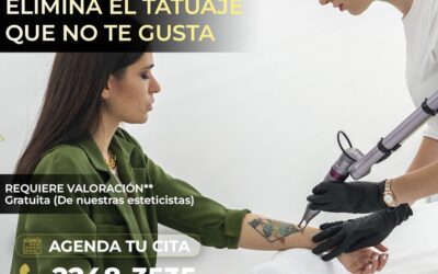 ¿Deseas eliminar el tatuaje que ya no te gusta?, Nosotros te ayudamos. 👇😉