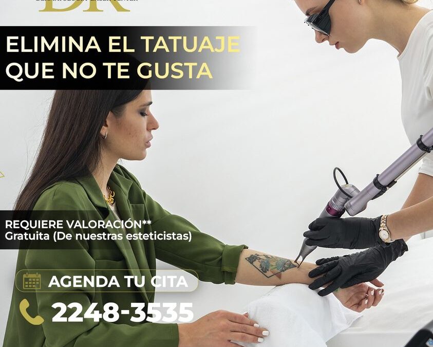 ¿Deseas eliminar el tatuaje que ya no te gusta?, Nosotros te ayudamos. 👇😉