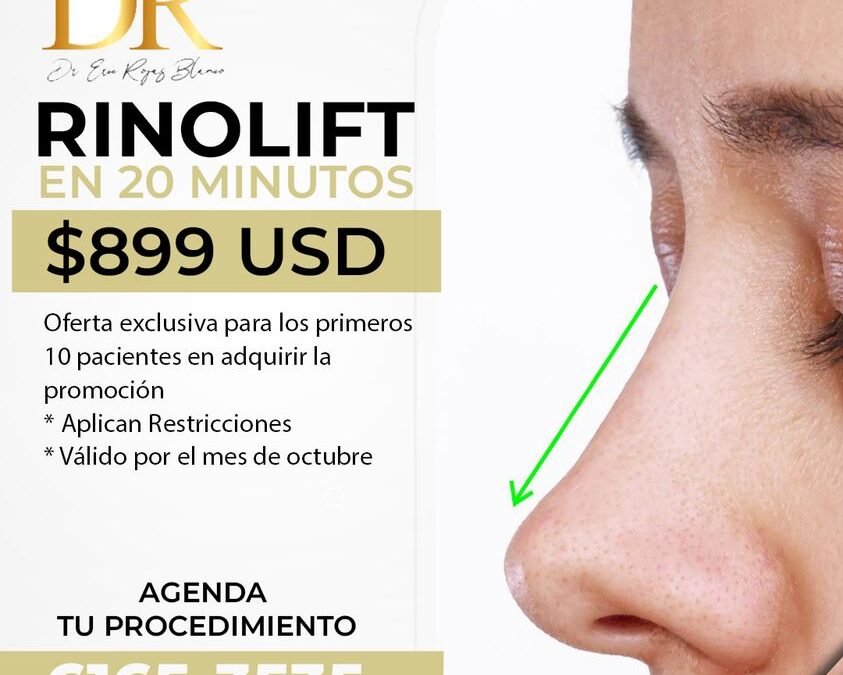 Oferta de Rinolift por solo $899 por el mes de octubre.