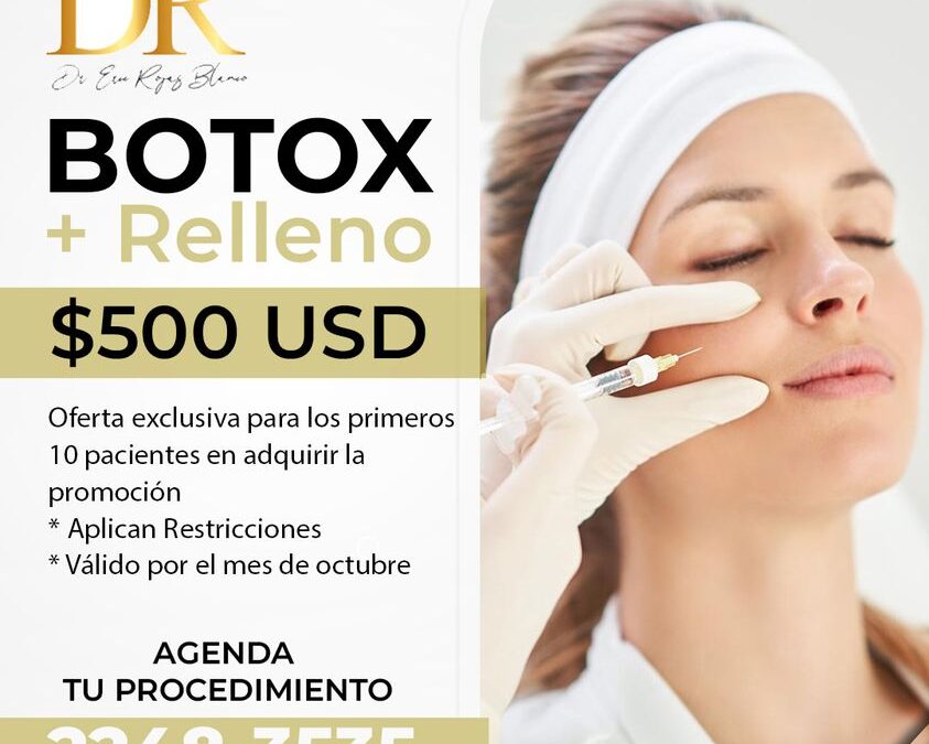 Botox + Relleno en $500 dólares, ¡Aprovecha!