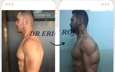 lim láser genera excelentes resultados en marcaje.