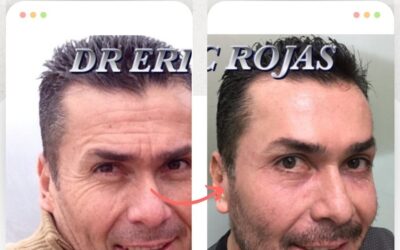 Rejuvenece tu rostro y luce increíble.