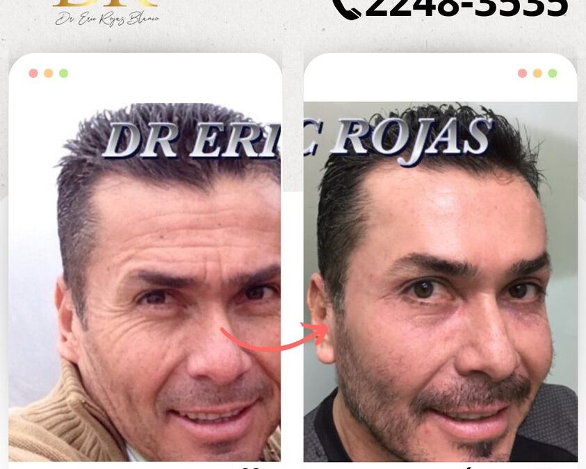 Rejuvenece tu rostro y luce increíble.
