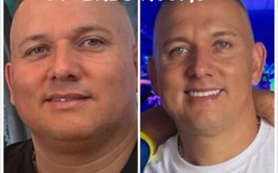 Slim Láser logra resultados magníficos.
