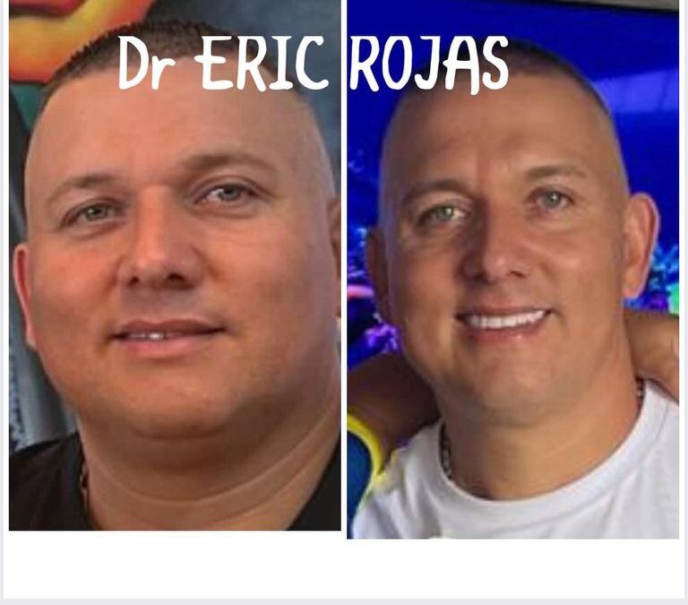 Slim Láser logra resultados magníficos.