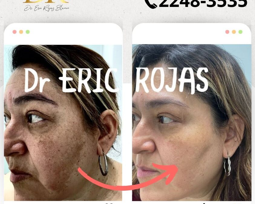 Elimina las manchas de tu vida de manera definitiva.