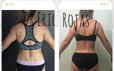 Slim Láser genera los resultados que tanto deseas.