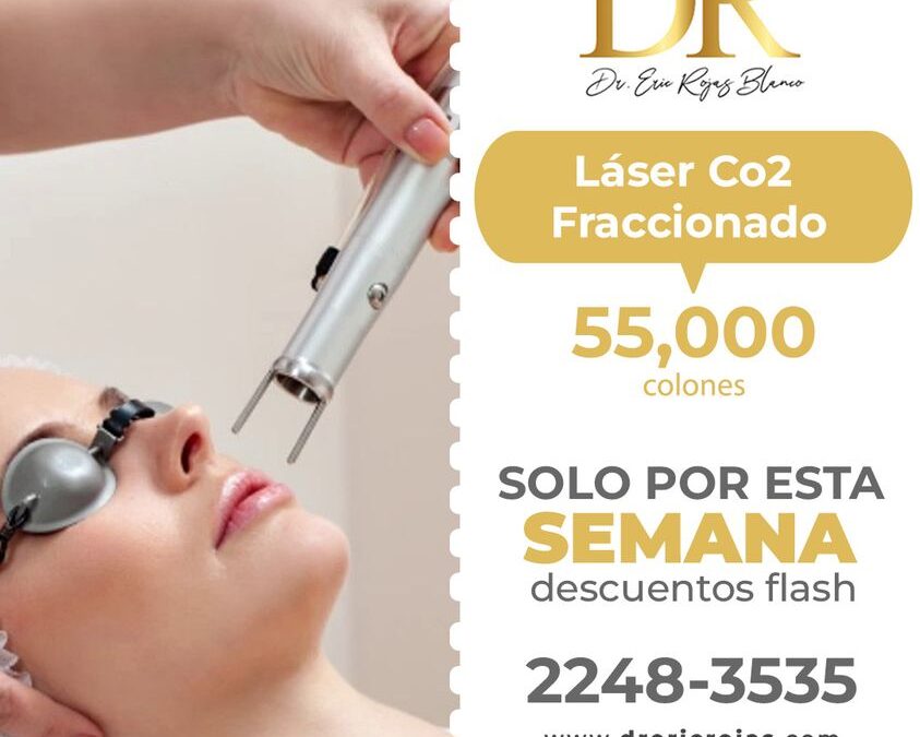 Solo por esta semana, Láser Co2 fraccionado en 55,000 colones por sesión.