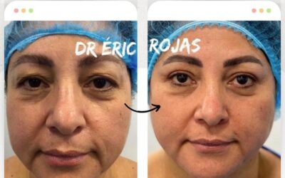 Dr. Eric Rojas