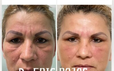 Rejuvenece tu rostro y obtén los cambios que deseas.