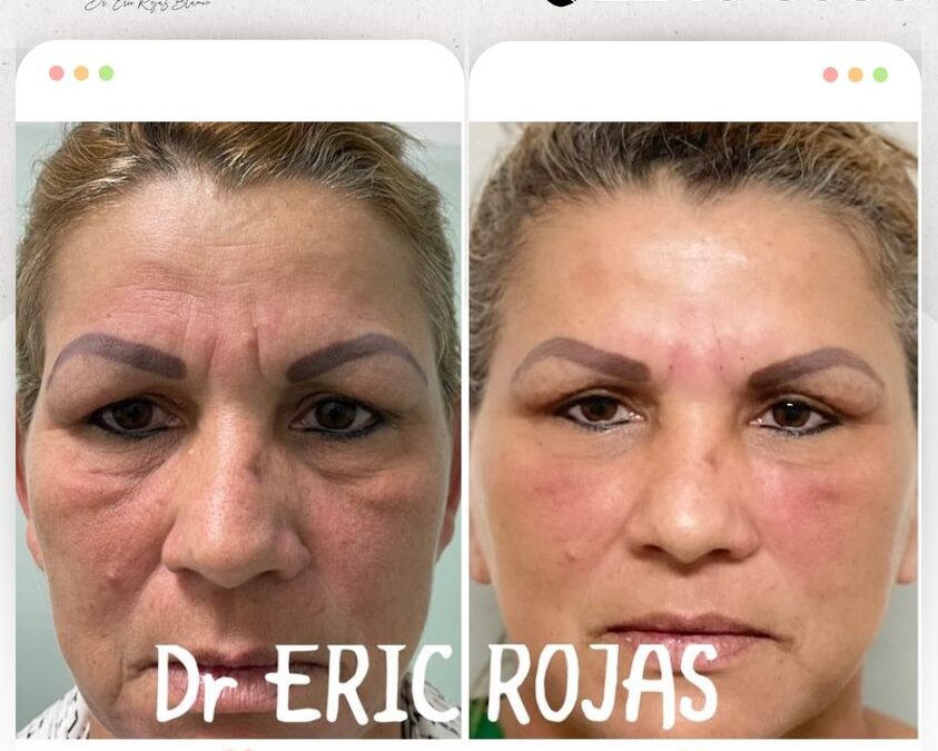 Rejuvenece tu rostro y obtén los cambios que deseas.