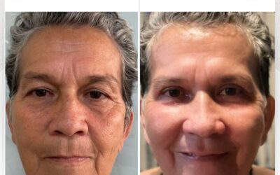 Rejuvenece tu rostro.