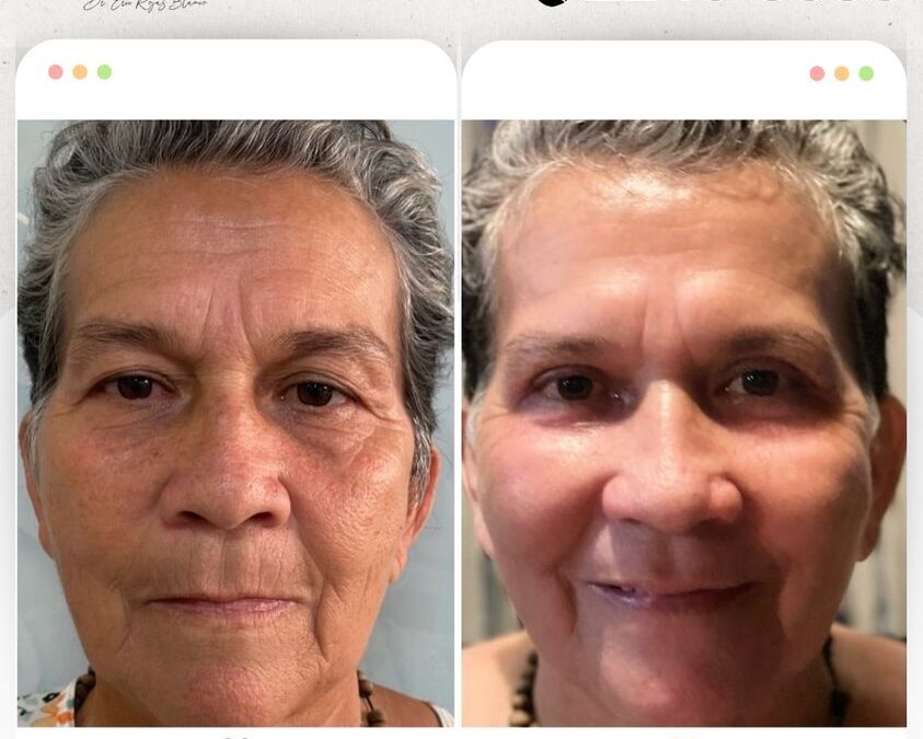 Rejuvenece tu rostro.