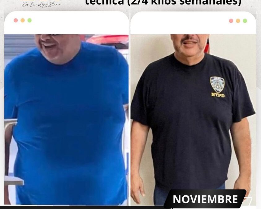 Baja increíblemente de peso con el mejor tratamiento.