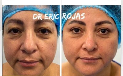 ¡Aún tienes tiempo!, aprovecha la oportunidad de realizarte un refrescamiento facial.