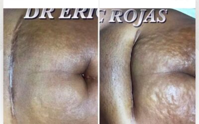 ¿Qué esperas para mejorar las tuyas?