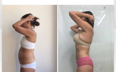 Slim Láser, increíbles cambios en tu cuerpo.