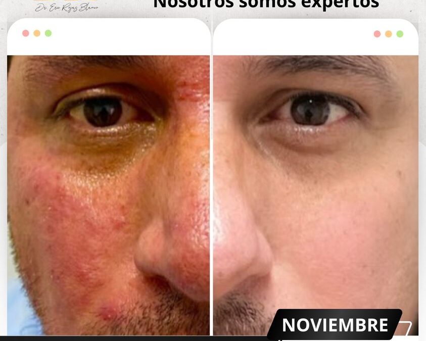 Somos expertos en temas de piel