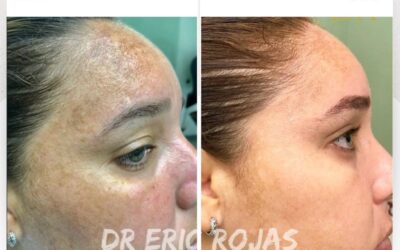 Tenemos la solución para limpiar tu rostro.